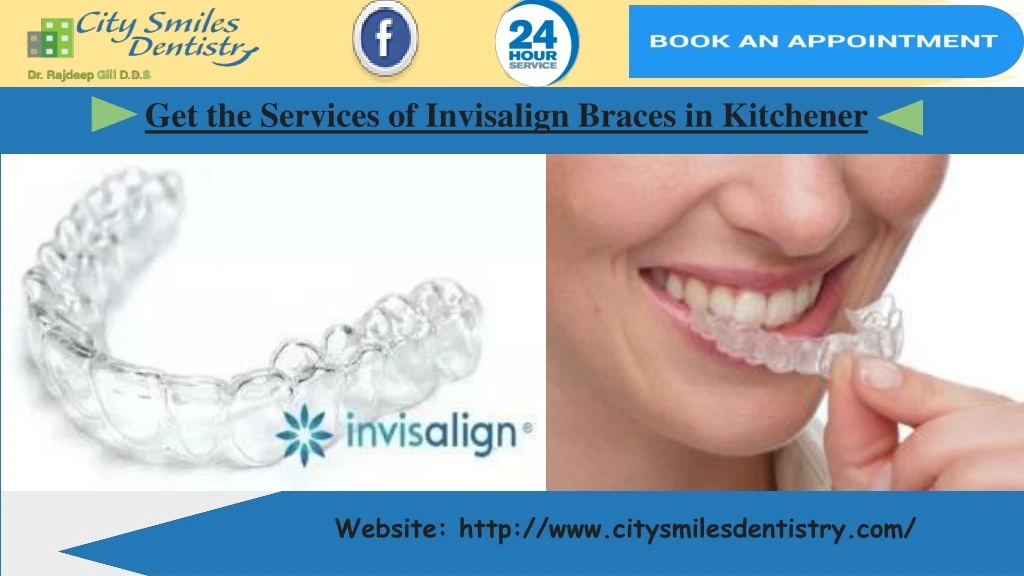 get the services of invisalign braces in kitchener