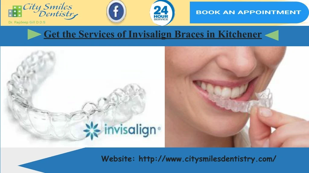 get the services of invisalign braces in kitchener