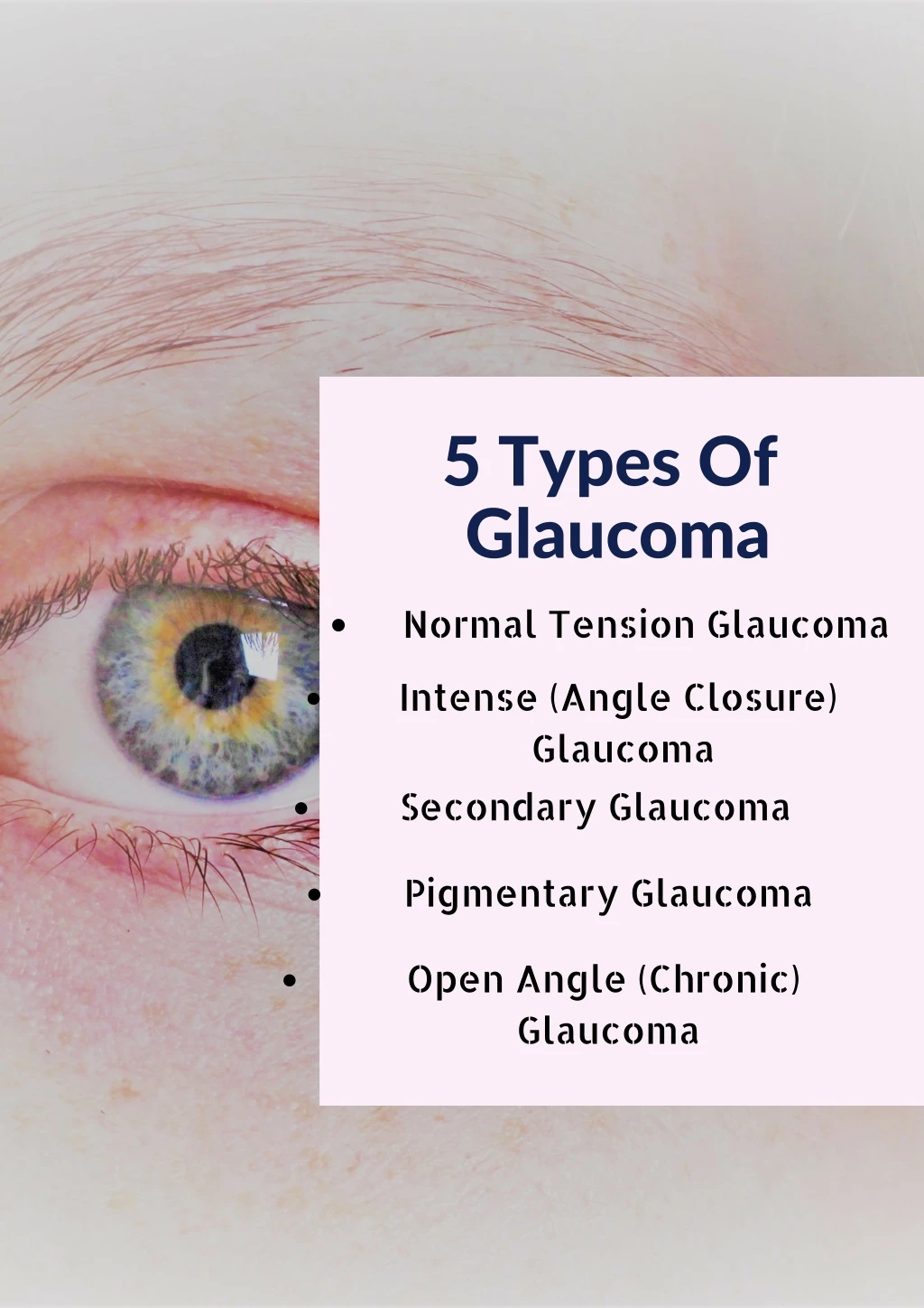 5 types of glaucoma