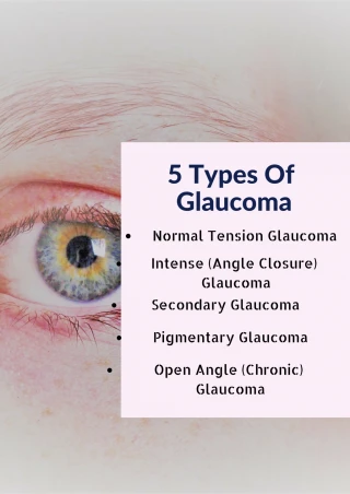 PPT - TYPES OF GLAUCOMA PowerPoint Presentation, free download - ID:3318826