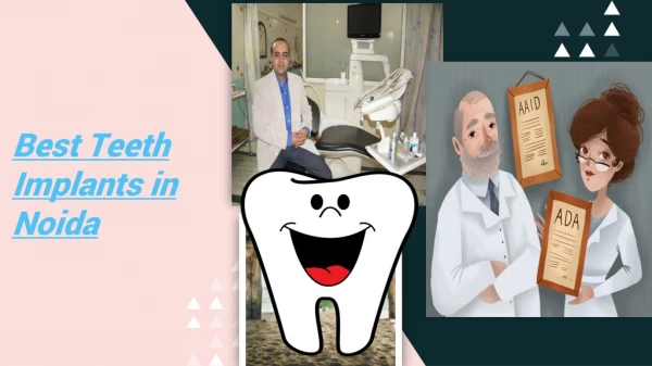Best Teeth Implants in Noida