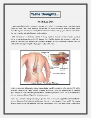 Herniated Disc - slide 1