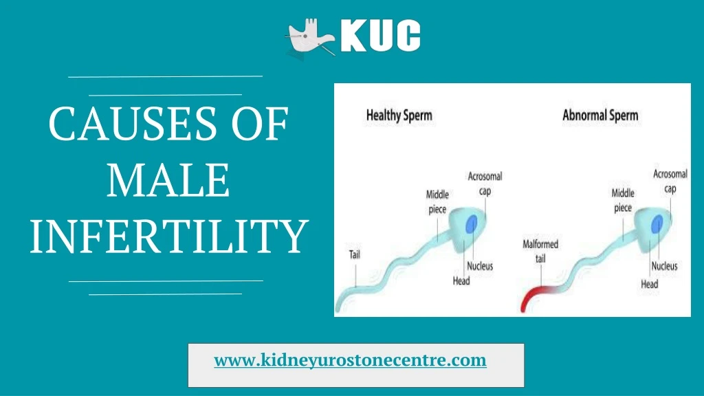 causes of male infertility