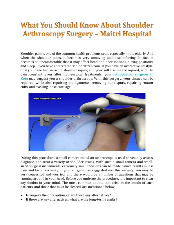 What You Should Know About Shoulder Arthroscopy Surgery – Maitri Hospital