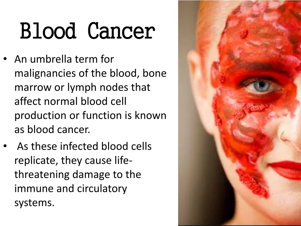 blood cancer