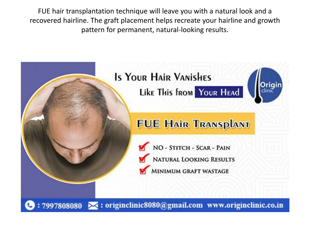 fue hair transplantation technique will leave