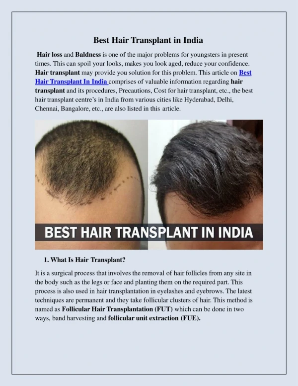 Best Hair Transplant in India