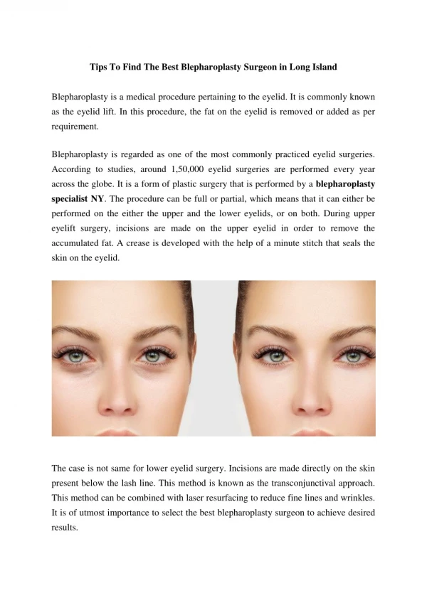 Hoe to Find The Best Blepharoplasty Surgeon in Long Island