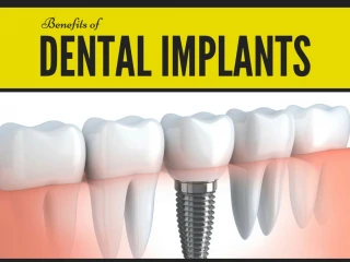 Repair your Jawbone by Bone Grafting - slide 1
