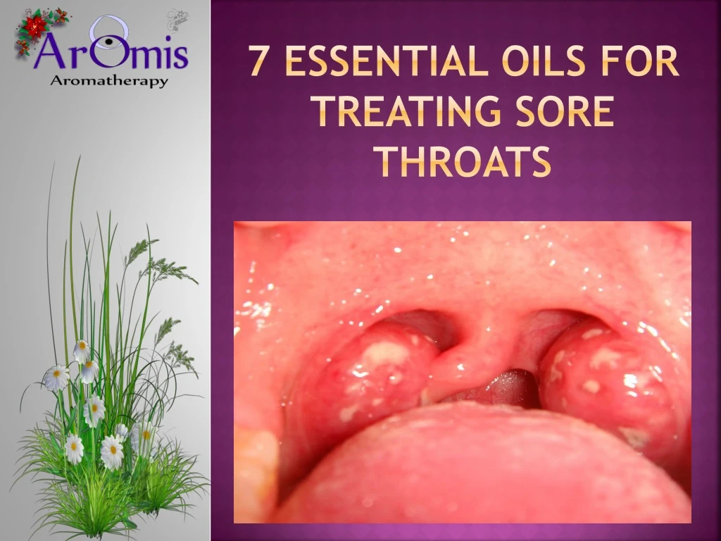 7 essential oils for treating sore throats