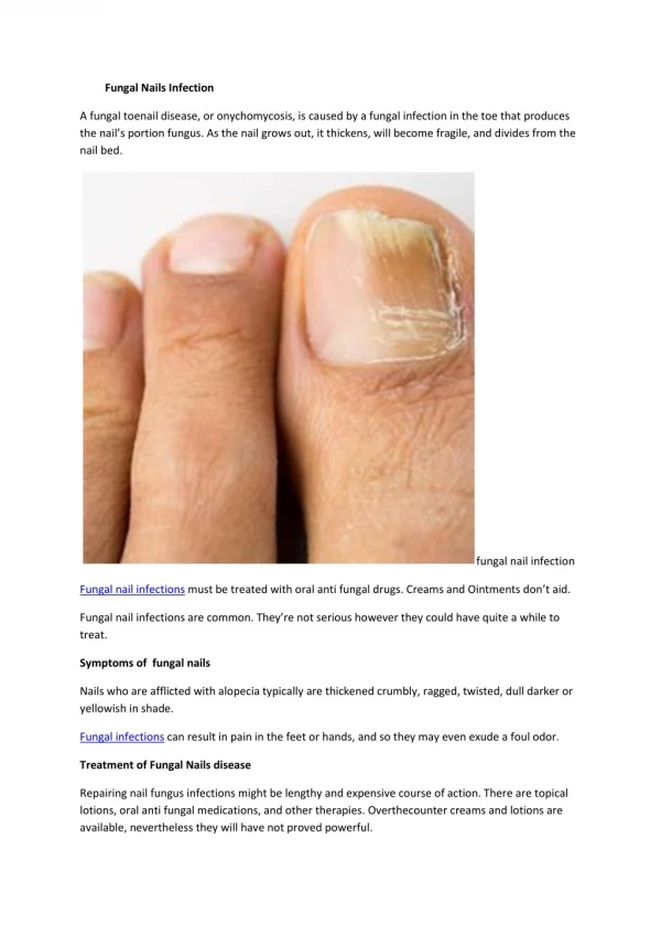 Fungal Nails Infection