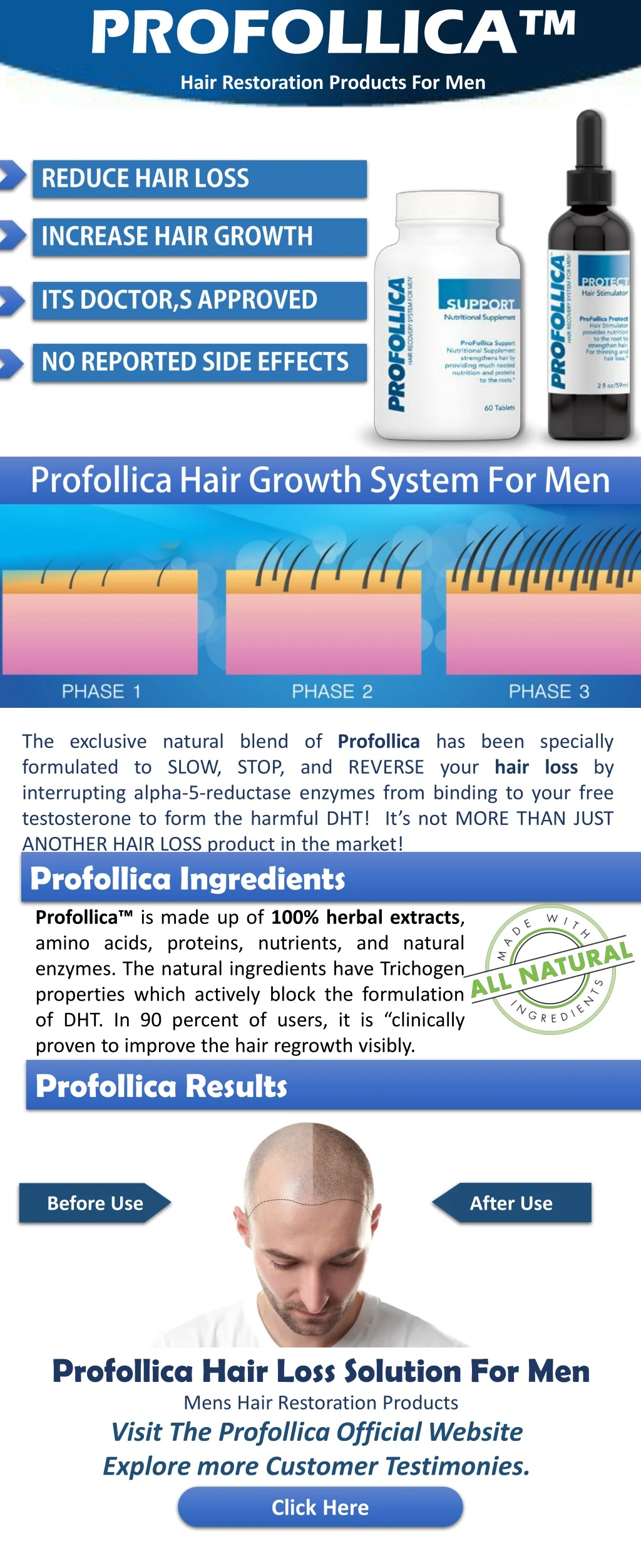 profollica hair restoration products for men