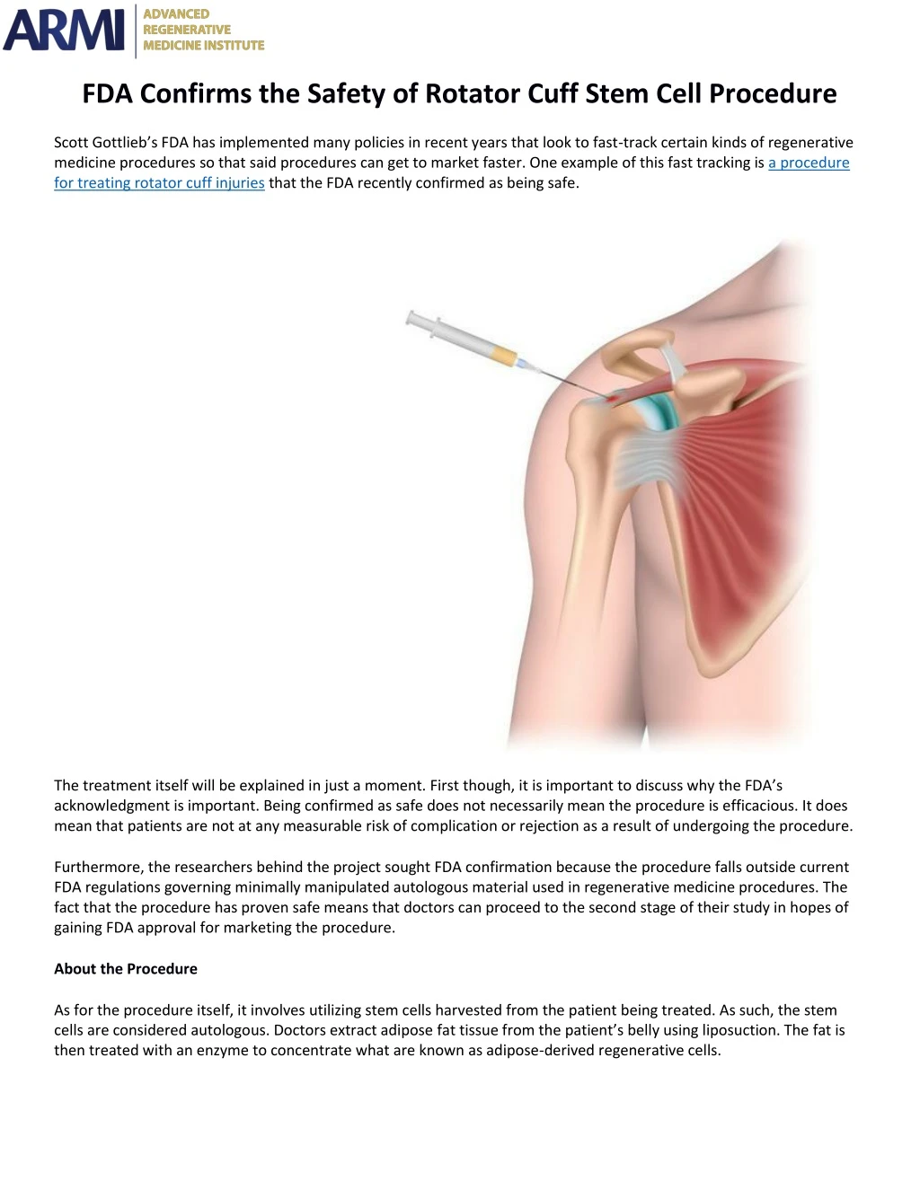 fda confirms the safety of rotator cuff stem cell