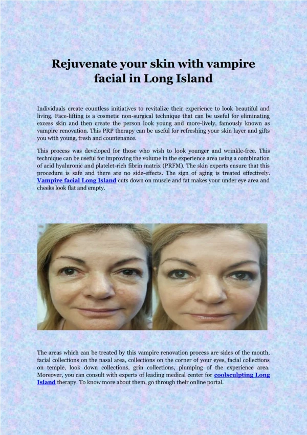 Rejuvenate your skin with vampire facial in Long Island
