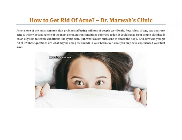 How To Get Rid Of Acne? - Dr. Marwah's Clinic