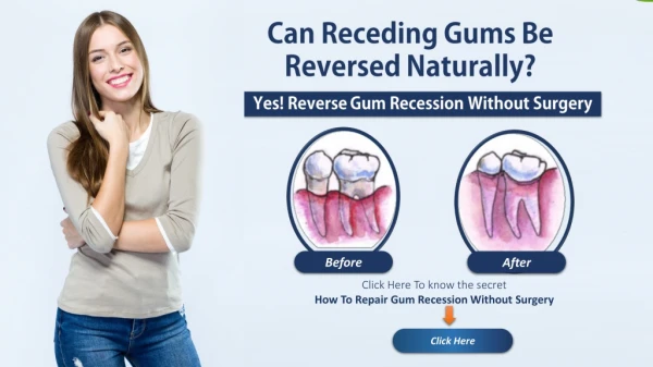 Reverse Receding Gums Naturally