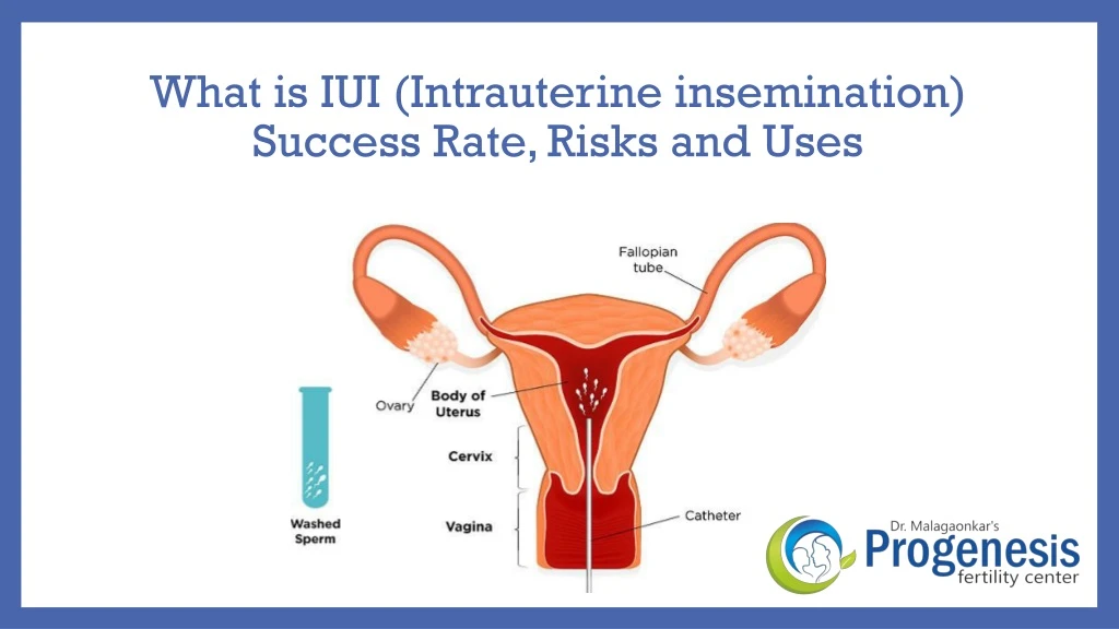 what is iui intrauterine insemination success rate risks and uses