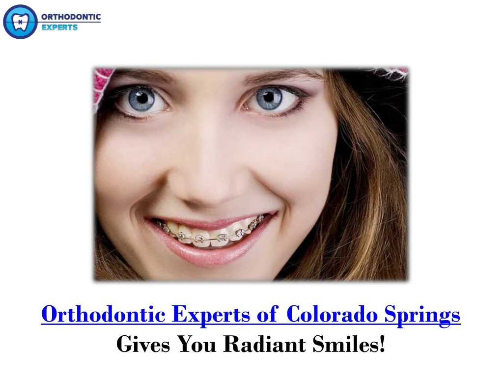 orthodontic experts of colorado springs gives you radiant smiles