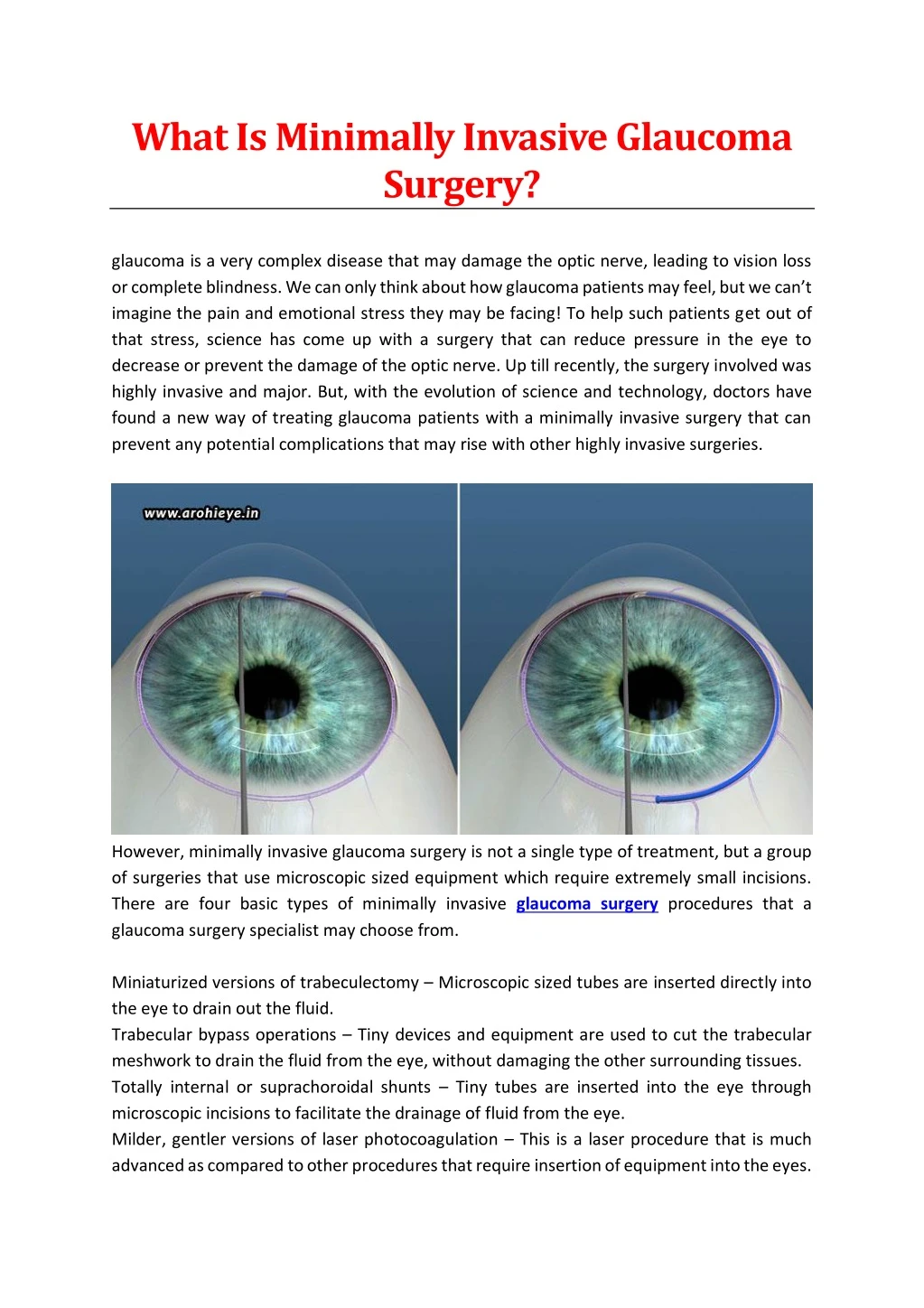 what is minimally invasive glaucoma surgery