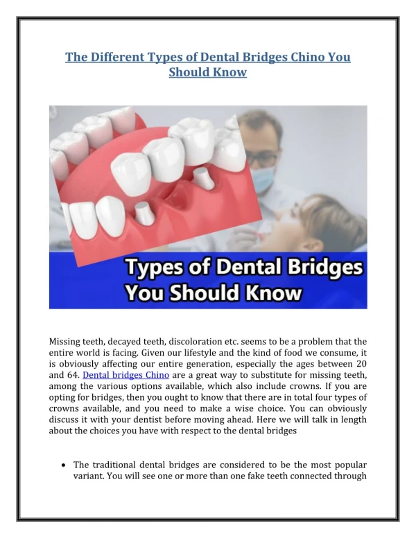 The Different Types of Dental Bridges Chino You Should Know