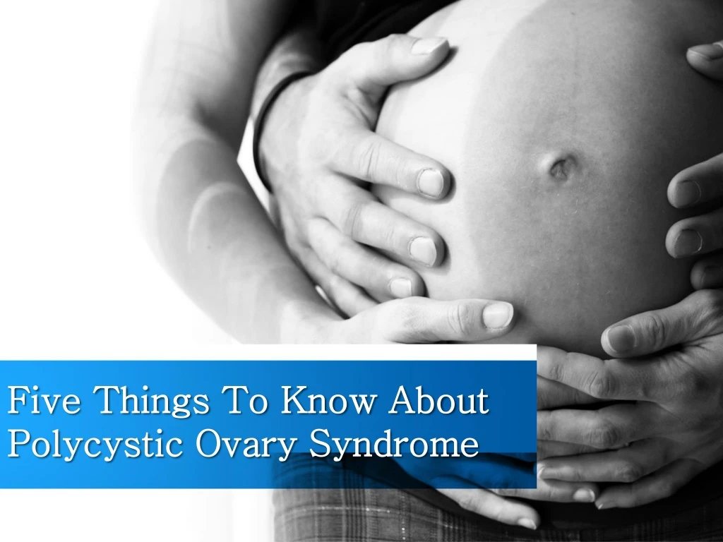 five things to know about polycystic ovary syndrome