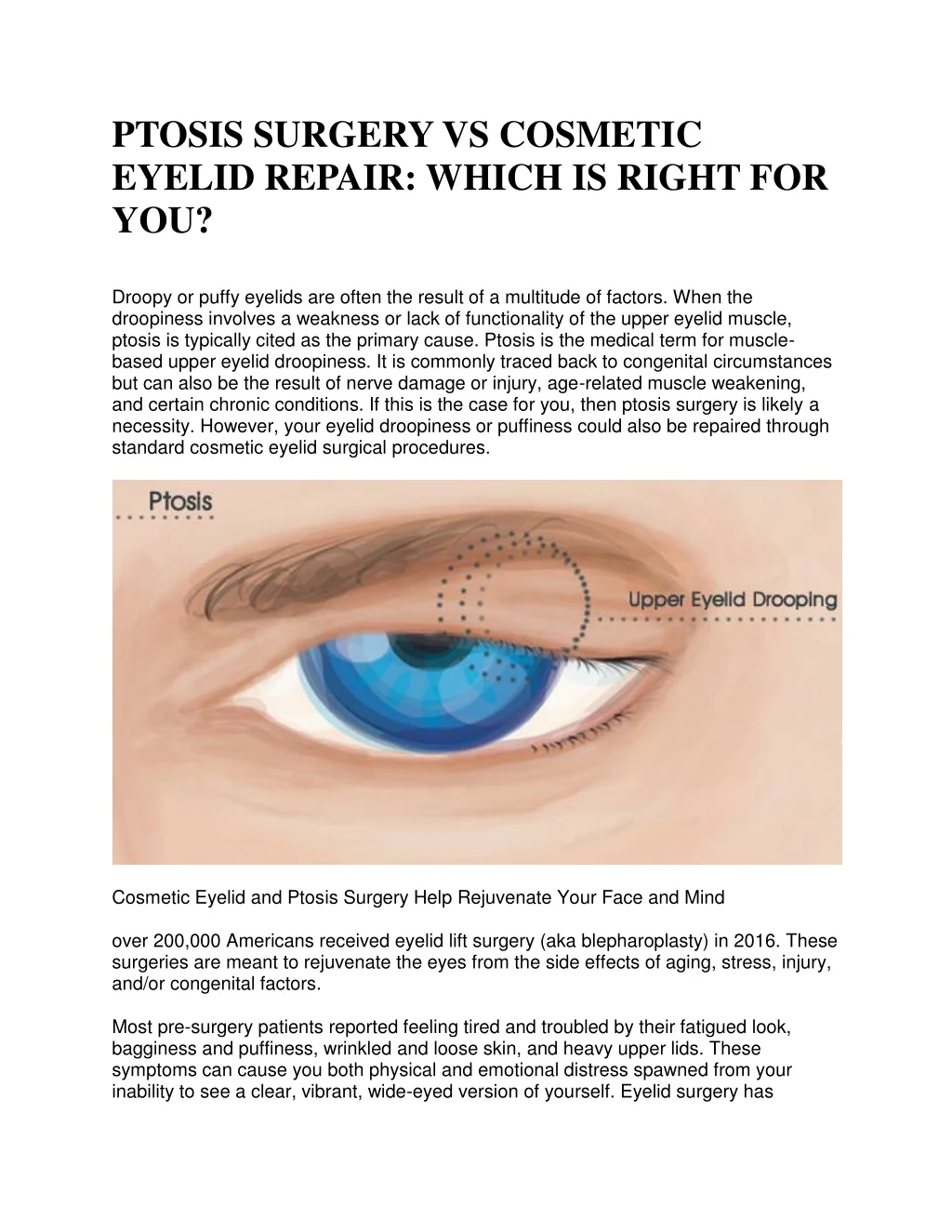 ptosis surgery vs cosmetic eyelid repair which