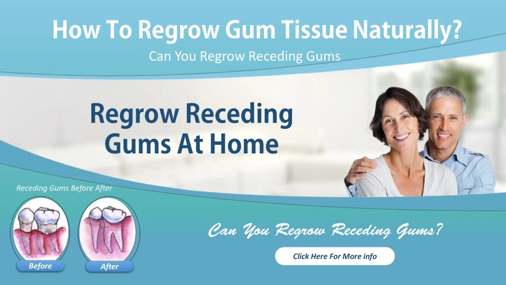 can you regrow receding gums