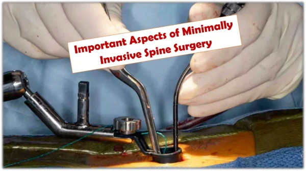 Important Aspects of Minimally Invasive Spine Surgery