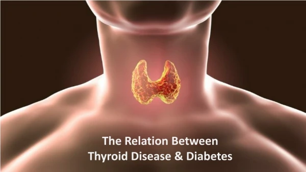 The Relation Between Thyroid Disease & Diabetes