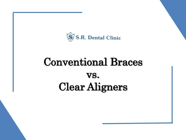 SR DENTAL – Conventional Braces vs Clear Aligners