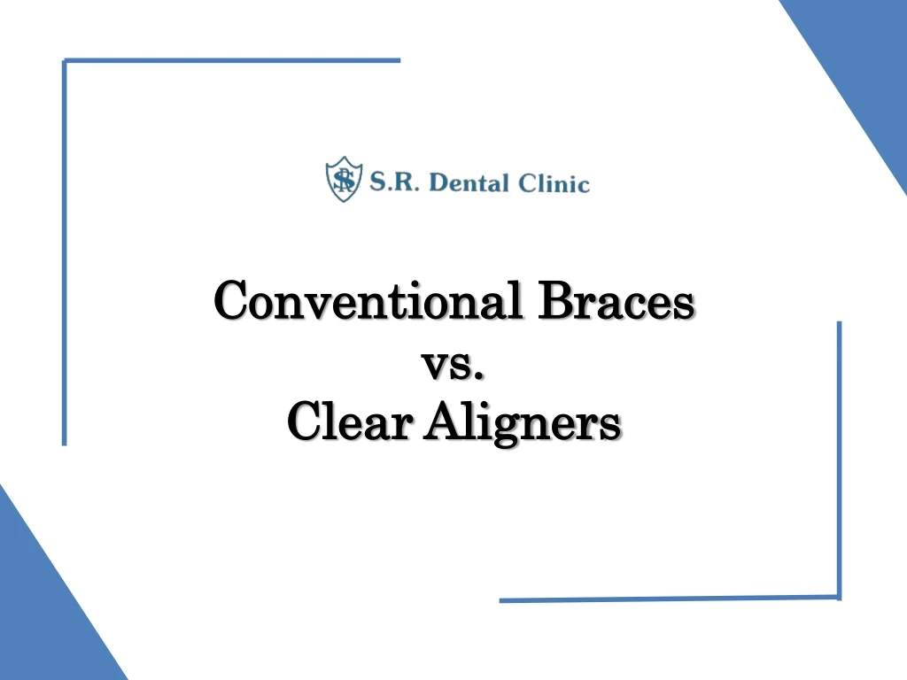 conventional braces vs clear aligners