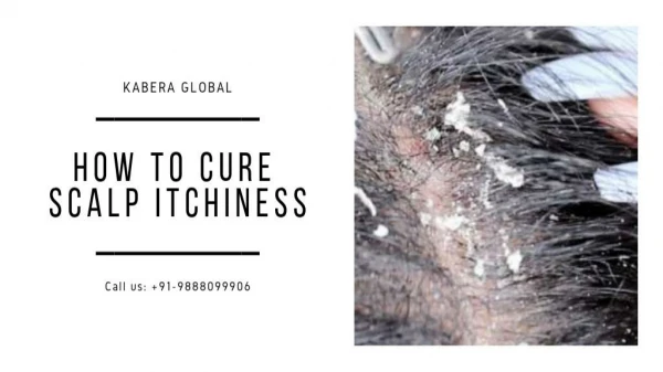 How to Cure Scalp Itchiness?