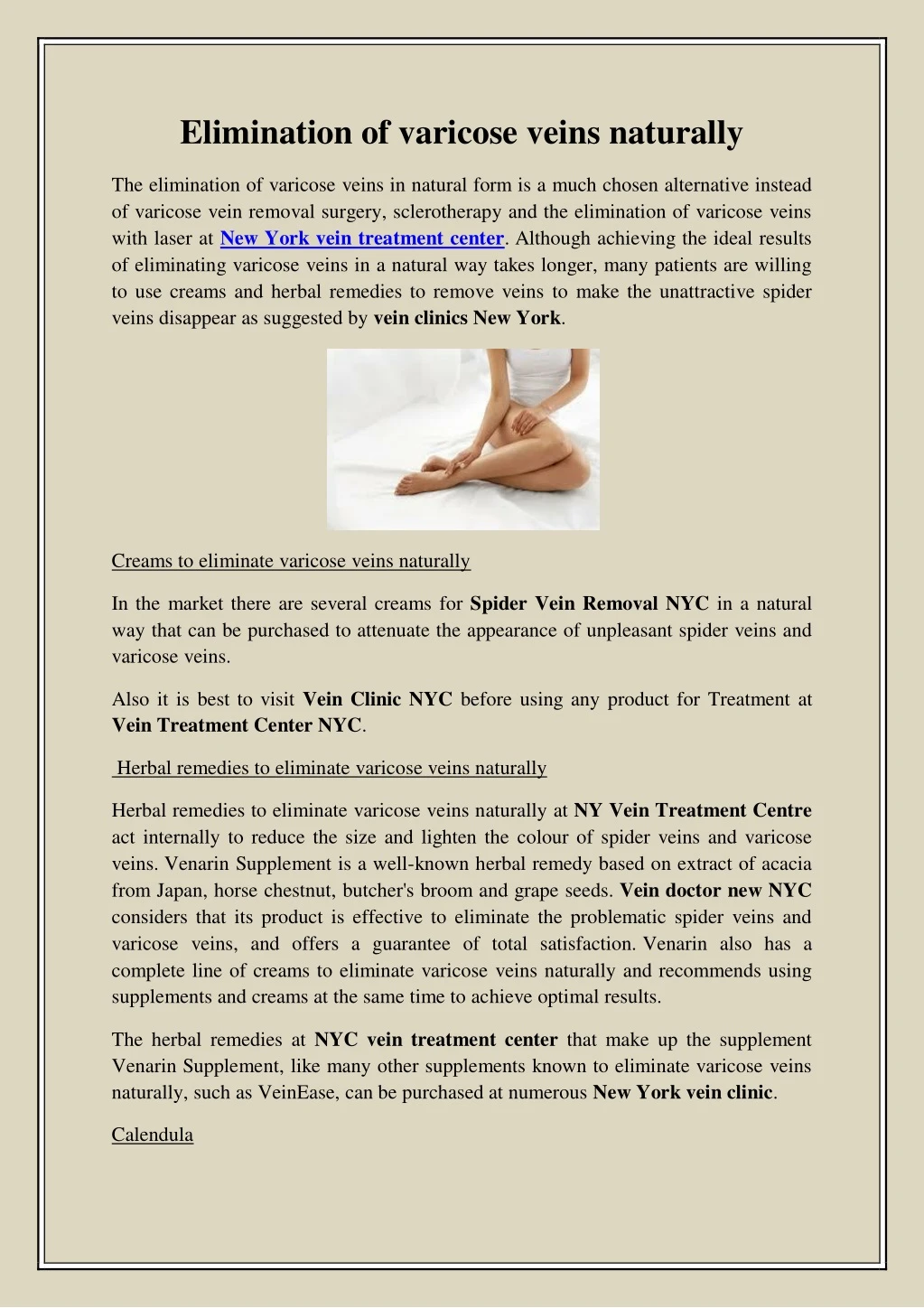 elimination of varicose veins naturally