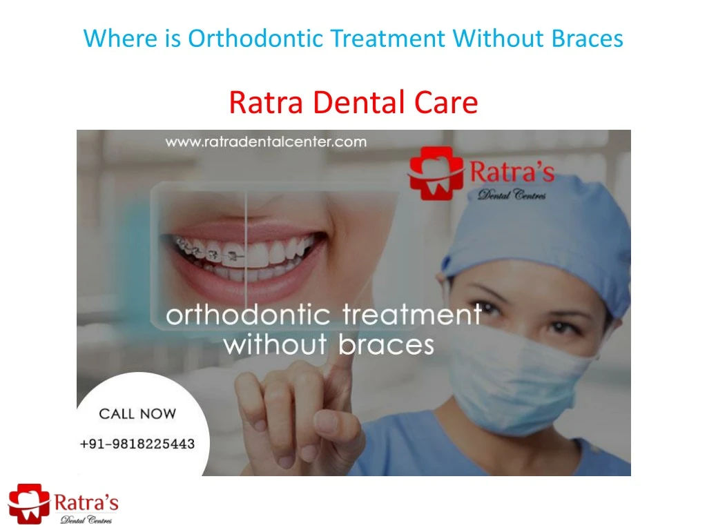 where is orthodontic treatment without braces