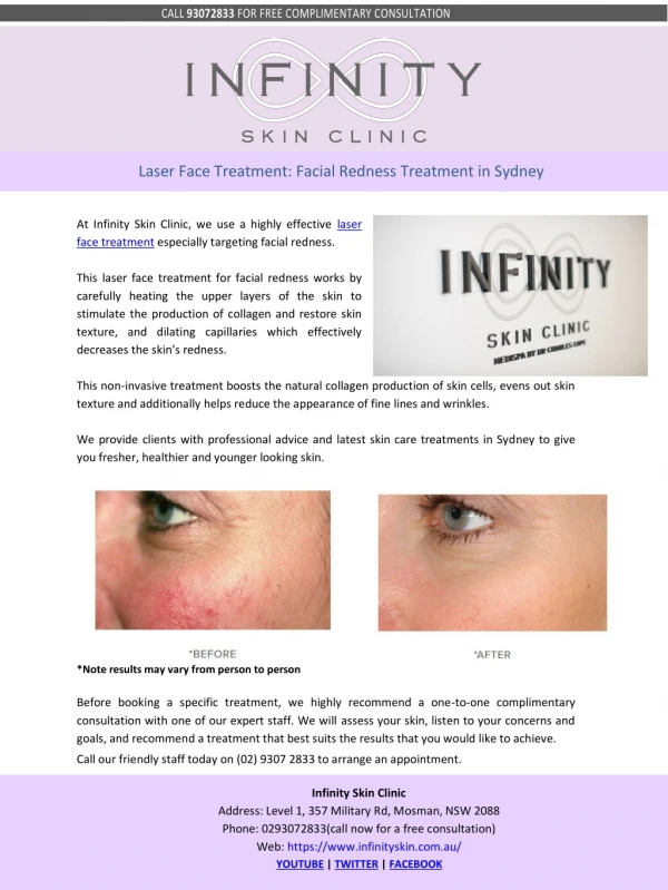 Laser Face Treatment: Facial Redness Treatment in Sydney