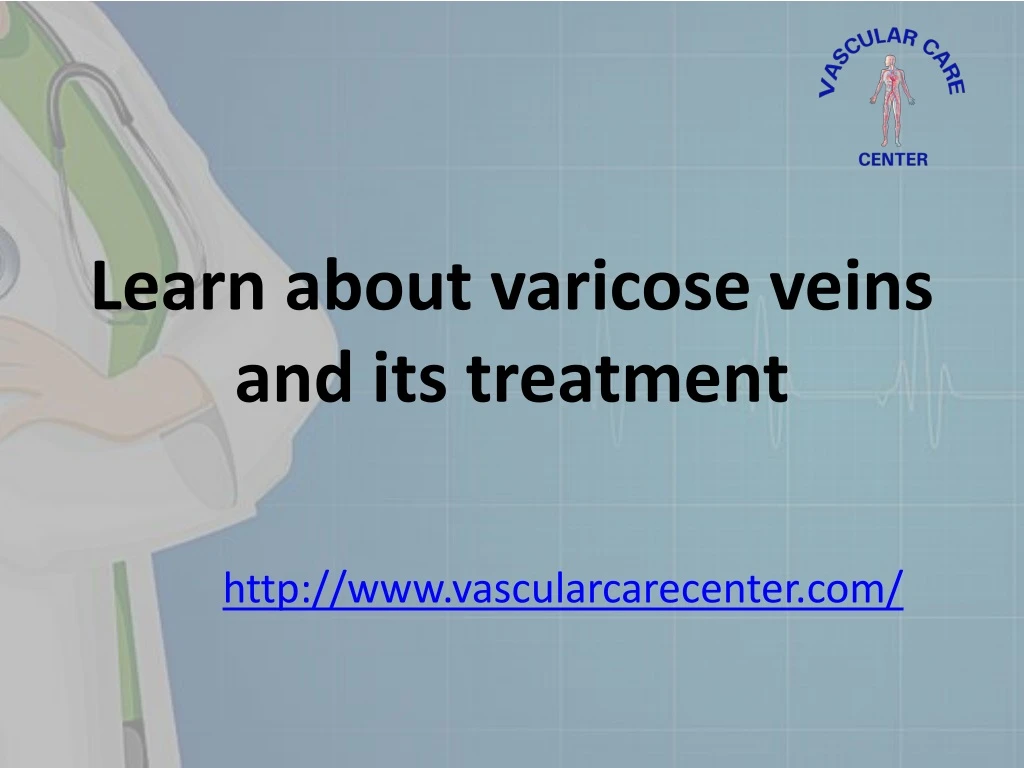 learn about varicose veins and its treatment