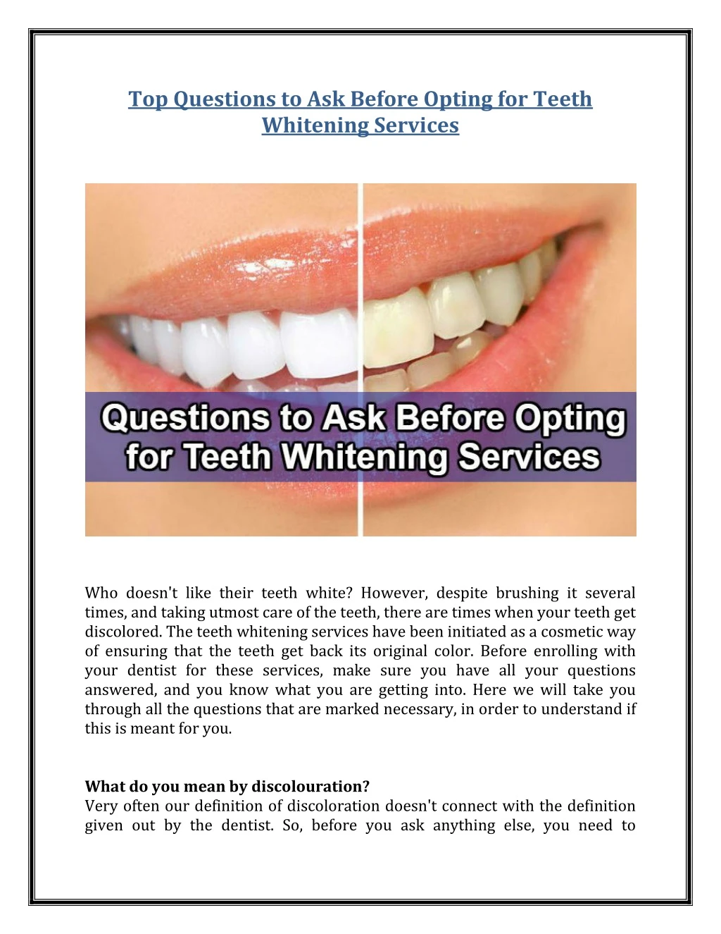 top questions to ask before opting for teeth