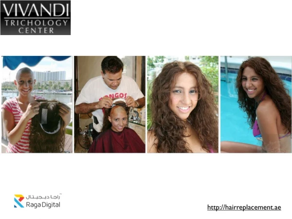 Female Non Surgical Hair Replacement Dubai