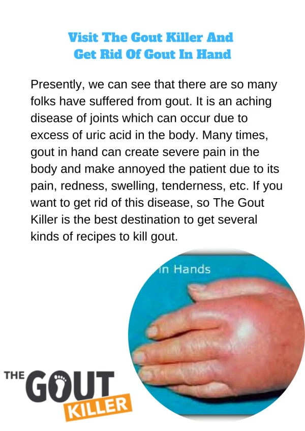 Visit The Gout Killer And Get Rid Of Gout In Hand