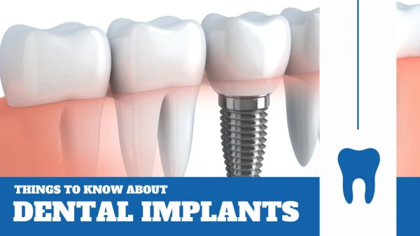 Advanced Dental Implant Treatment
