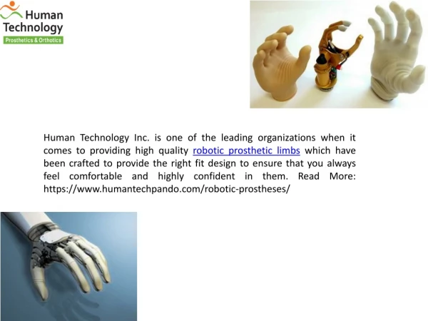 High Quality Robotic Prosthetic Limbs