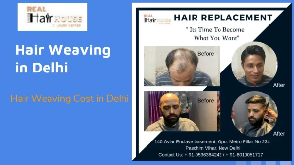 Hair Weaving Cost in Delhi