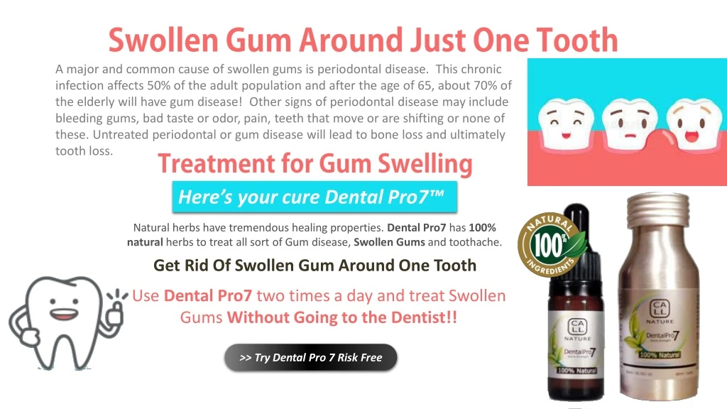 a major and common cause of swollen gums