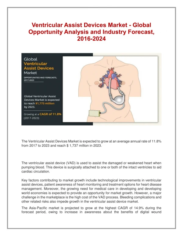 Ventricular Assist Devices Market - Global Opportunity Analysis and Industry Forecast