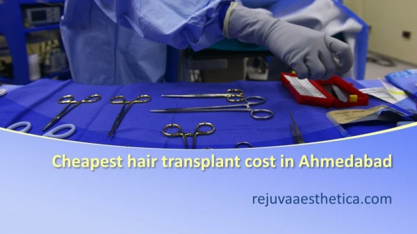cheapest-hair-transplant-cost-in-ahmedabad