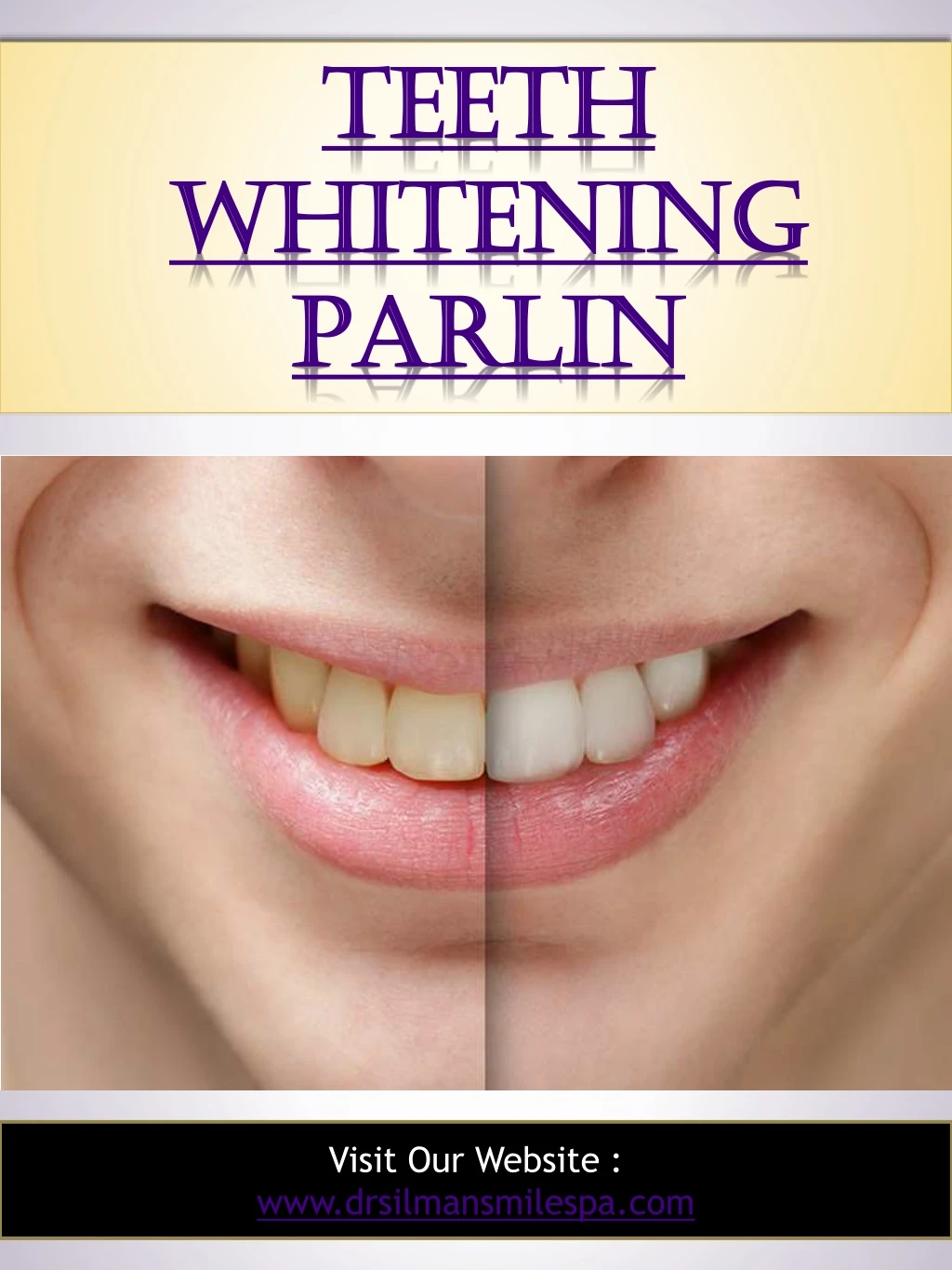 teeth teeth whitening whitening parlin parlin
