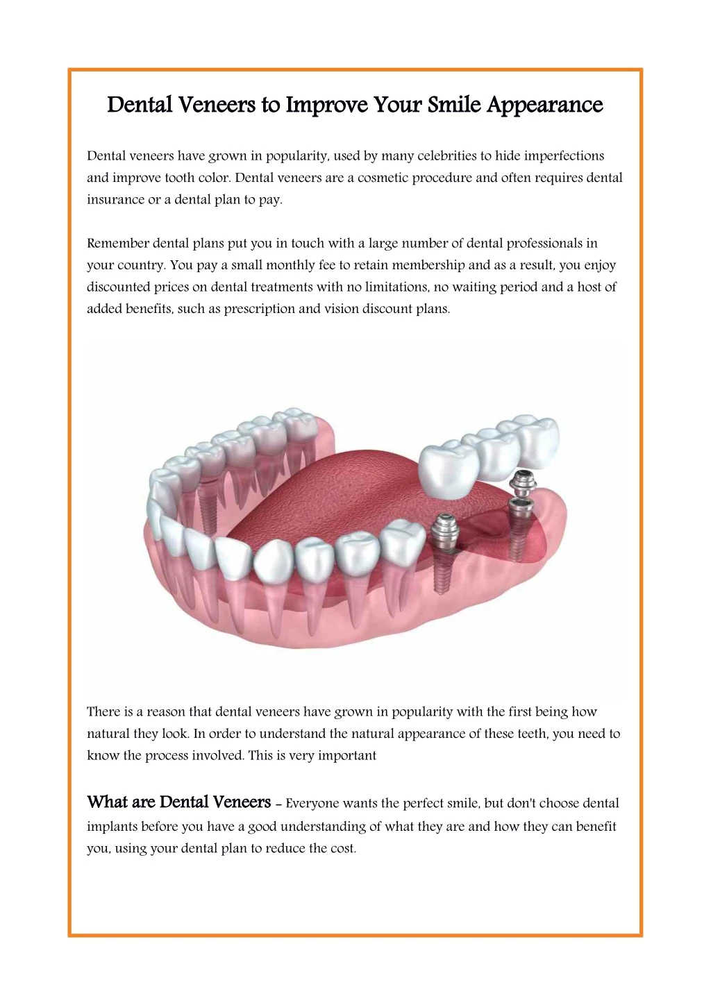 dental veneers to improve your smile appearance