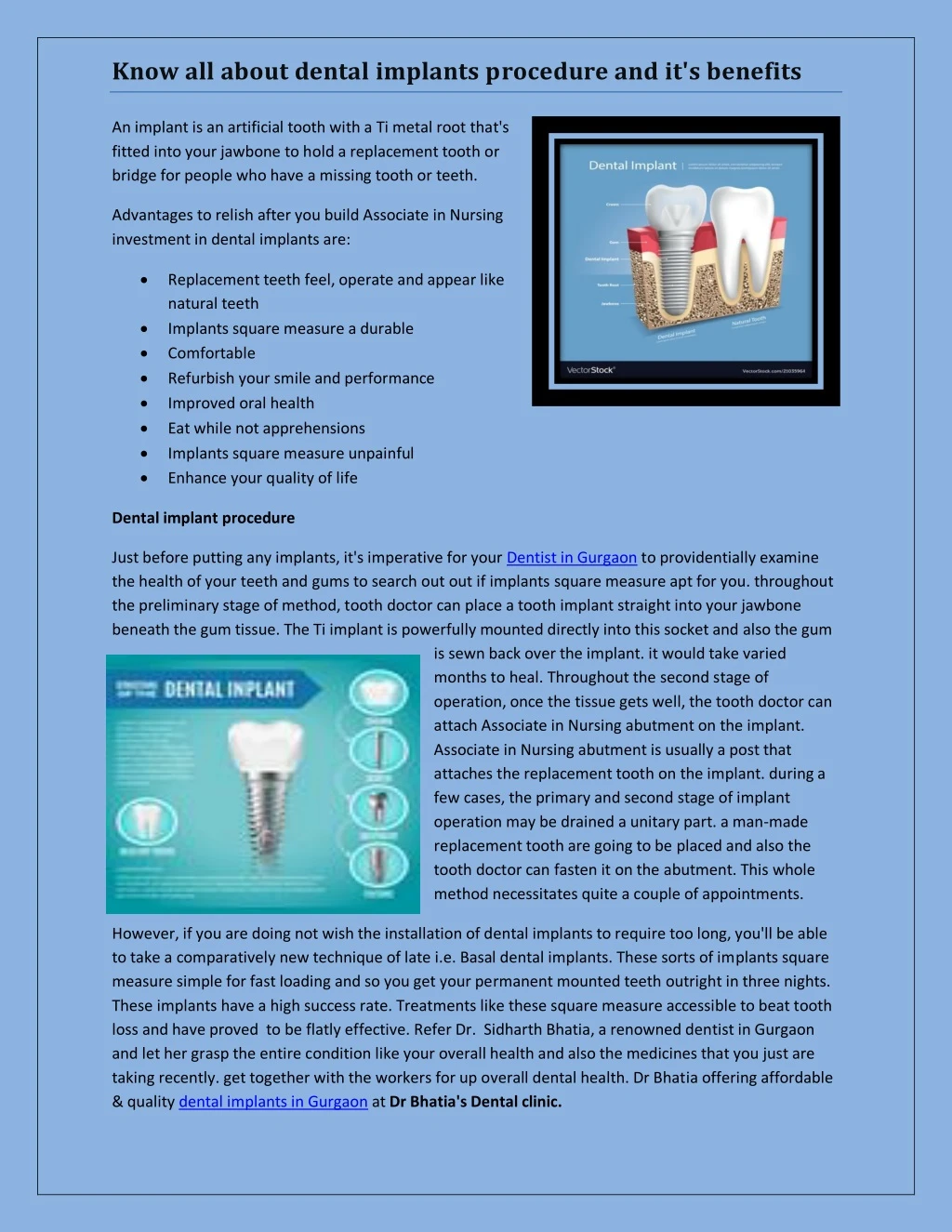 know all about dental implants procedure