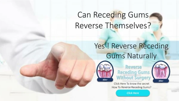 Reverse Receding Gums Without Surgery