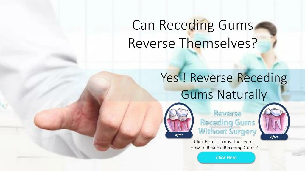 can receding gums reverse themselves